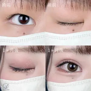 AI Beauty Clinic （エーアイ美容クリニック） 尾崎 宥文医師の症例