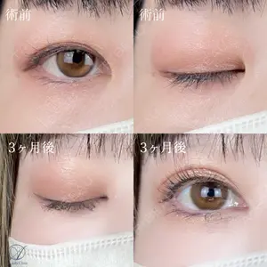AI Beauty Clinic （エーアイ美容クリニック） 尾崎 宥文医師の症例