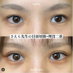 EMMO FACE CLINIC 大阪梅田院 山﨑 冴羅医師の症例