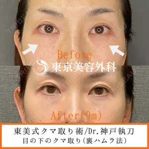 東京美容外科 青森院の症例