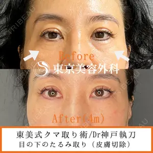 東京美容外科 青森院の症例