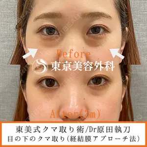 東京美容外科 池袋院 原田 崇史医師の症例