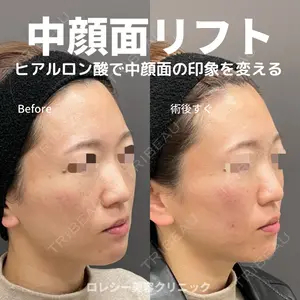 ロレシー美容クリニック 心斎橋駅前院 高田先生医師の症例