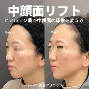 ロレシー美容クリニック 心斎橋駅前院 高田先生医師の症例