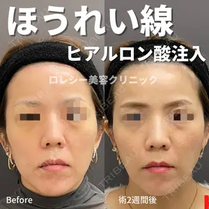 ロレシー美容クリニック 心斎橋駅前院 高田先生医師の症例