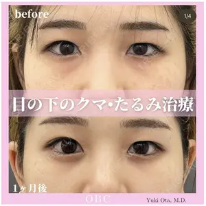 お茶の水美容形成クリニック 太田　有紀医師の症例