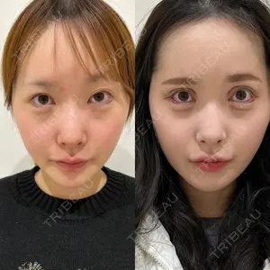 エターナル美容クリニック 久門田 詳医師の症例