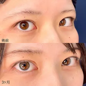 東京シンデレラ美容外科 大宮院の症例