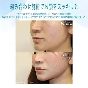 聖心美容クリニック 銀座院 牧野 陽二郎医師の症例