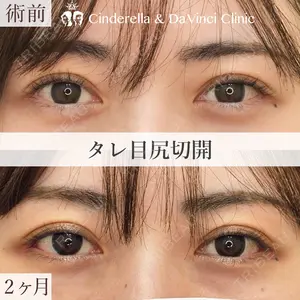 シンデレラ＆ダヴィンチクリニック 宮田 洋佑医師の症例
