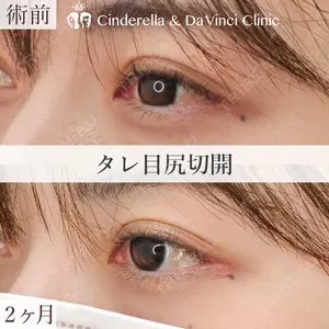 シンデレラ＆ダヴィンチクリニック 宮田 洋佑医師の症例