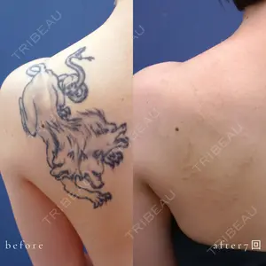 ガーデンクリニック 池袋院の症例