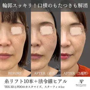 APスキンクリニック銀座の症例