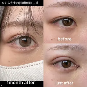 EMMO FACE CLINIC 大阪梅田院 山﨑 冴羅医師の症例