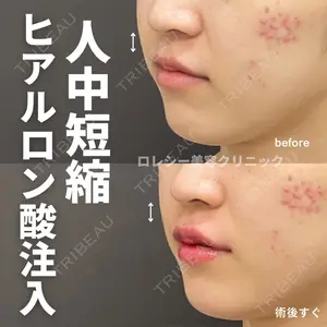 ロレシー美容クリニック 心斎橋駅前院 高田先生医師の症例