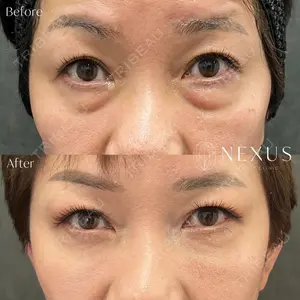 NEXUS CLINICの症例