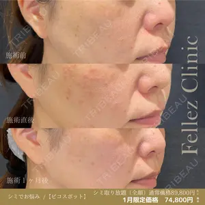 Fellez Clinic【フェルズクリニック】 小野 泰寛医師の症例