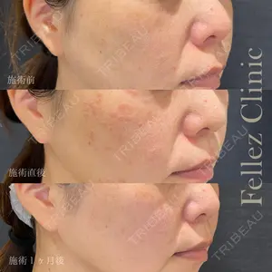 Fellez Clinic【フェルズクリニック】 小野 泰寛医師の症例