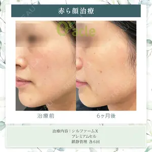 オラクル美容皮膚科 東京新宿院の症例