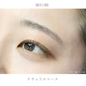 セカジソウォン医院-明洞店の症例