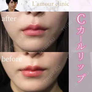 L‘amour clinic Tokyo【ラムールクリニック東京】の症例