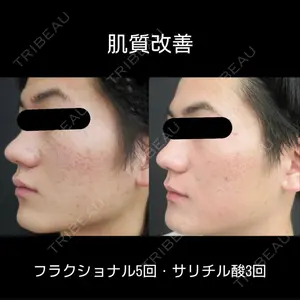 CHARIS BEAUTY CLINICの症例
