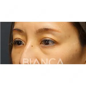 BIANCA銀座 堀田 和亮医師の症例