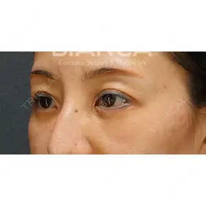 BIANCA銀座 堀田 和亮医師の症例