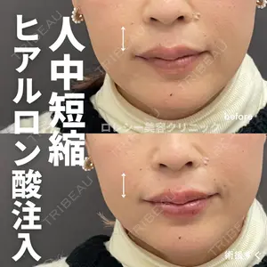 ロレシー美容クリニック 心斎橋駅前院 高田先生医師の症例