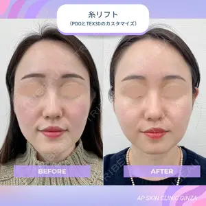 APスキンクリニック銀座の症例