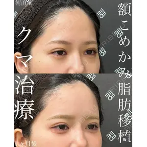 EMMO FACE CLINIC 大宮院 廣松 直樹医師の症例