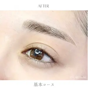 セカジソウォン医院-明洞店の症例