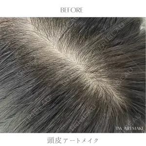 セカジソウォン医院-明洞店の症例