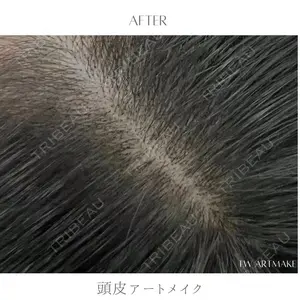 セカジソウォン医院-明洞店の症例