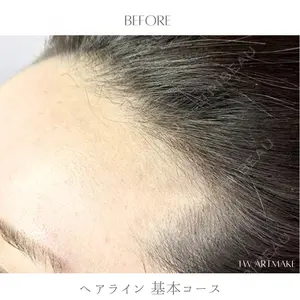 セカジソウォン医院-明洞店の症例