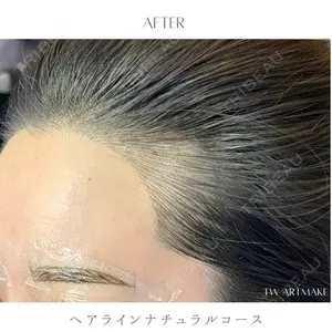 セカジソウォン医院-明洞店の症例