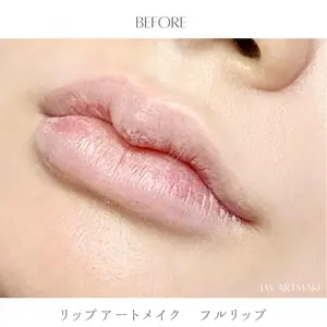 セカジソウォン医院-明洞店の症例