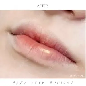 セカジソウォン医院-明洞店の症例