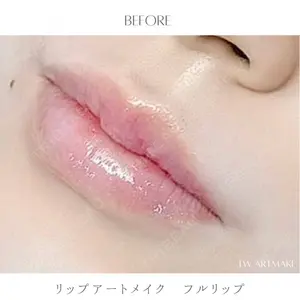セカジソウォン医院-明洞店の症例