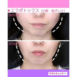 東京形成美容外科 船橋院 山崎 修吾医師の症例