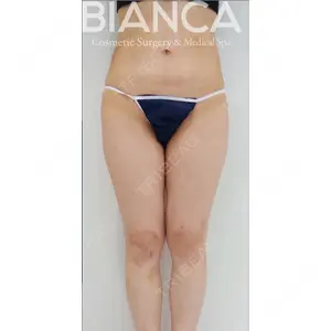 BIANCA銀座 堀田 和亮医師の症例