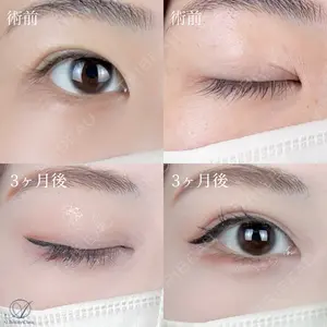 AI Beauty Clinic （エーアイ美容クリニック） 尾崎 宥文医師の症例