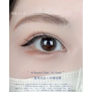 AI Beauty Clinic （エーアイ美容クリニック） 尾崎 宥文医師の症例