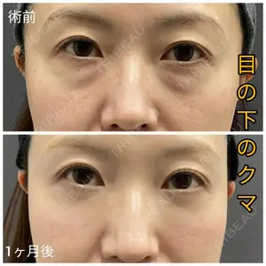 ゆきスキンクリニック 東池袋 小林 智之医師の症例