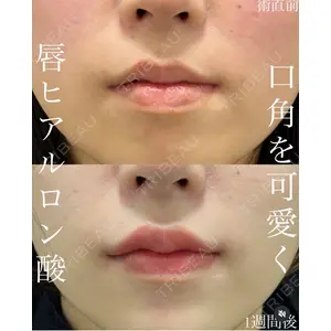 EMMO FACE CLINIC 大宮院 廣松 直樹医師の症例