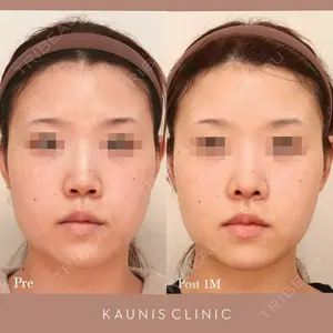 KAUNIS CLINIC（カウニスクリニック） 高野 敏郎医師の症例
