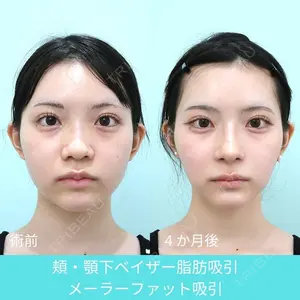 WOM CLINIC GINZA （ワム クリニック ギンザ） 深堀 純也医師の症例