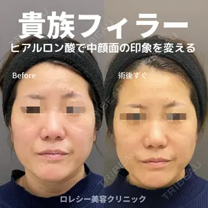 ロレシー美容クリニック 心斎橋駅前院 高田先生医師の症例