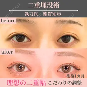広島プルミエクリニック 雑賀知歩医師の症例