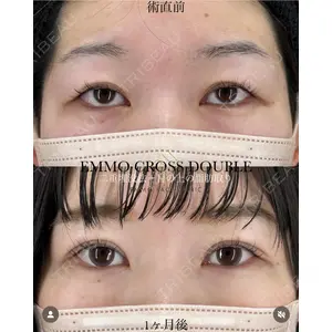 EMMO FACE CLINIC 大宮院 廣松 直樹医師の症例